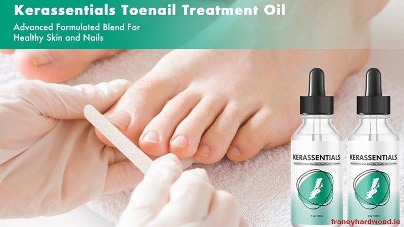 Kerassentials Use Case Illustration